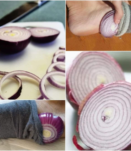 Examen de la extraña costumbre de dormir con una cebolla en los calcetines.