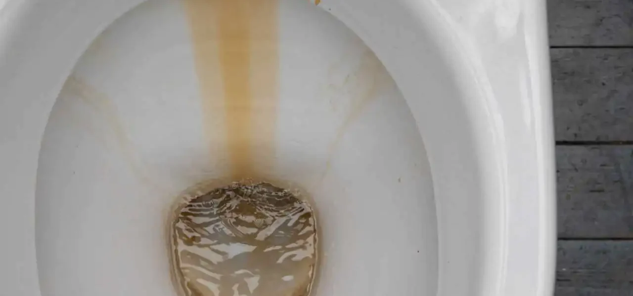 ¿Tu inodoro también tiene estas manchas? Te voy a contar cómo lo solucioné, ahora brilla.