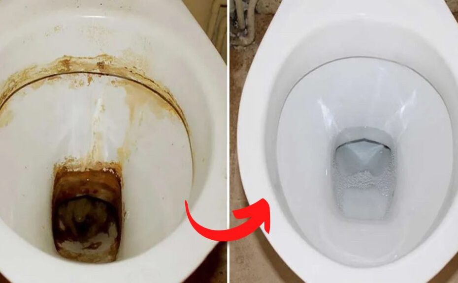 Este ingrediente elimina los restos de cal más difíciles de los inodoros