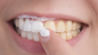 Blanquea tus dientes en casa de forma simple y rápida: lo que realmente funciona
